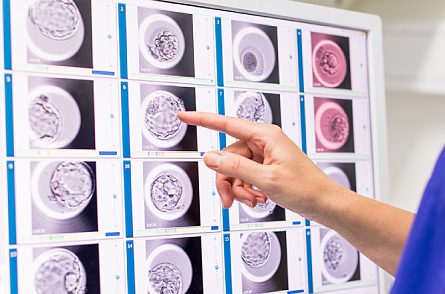 В клинике Эмбрио появился первый в ЮФО аппарат эмбриоскоп